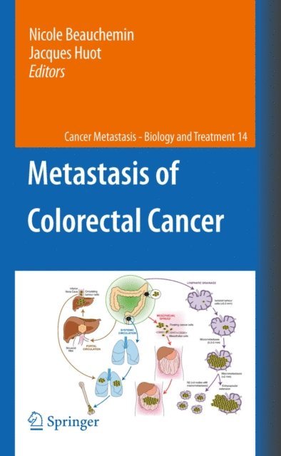 Jacques Huot, Nicole Beauchemin - Metastasis of Colorectal Cancer, E-bok