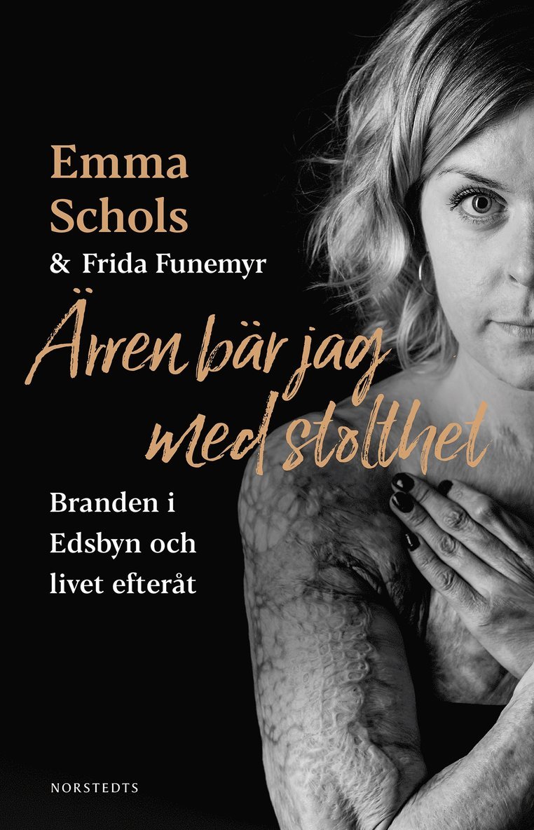 Emma Schols, Frida Funemyr - Ärren bär jag med stolthet : branden i Edsbyn och livet efteråt, E-bok