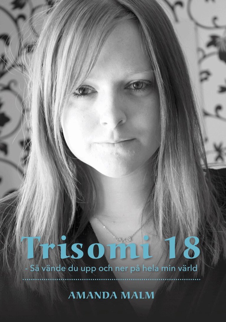 Amanda Malm - Trisomi 18 : så vände du upp och ner på hela min värld, Häftad