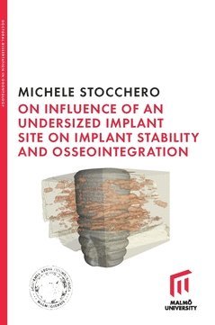 Michele Stocchero - On influence of undersized implant site on implant stability and osseointegration, Häftad