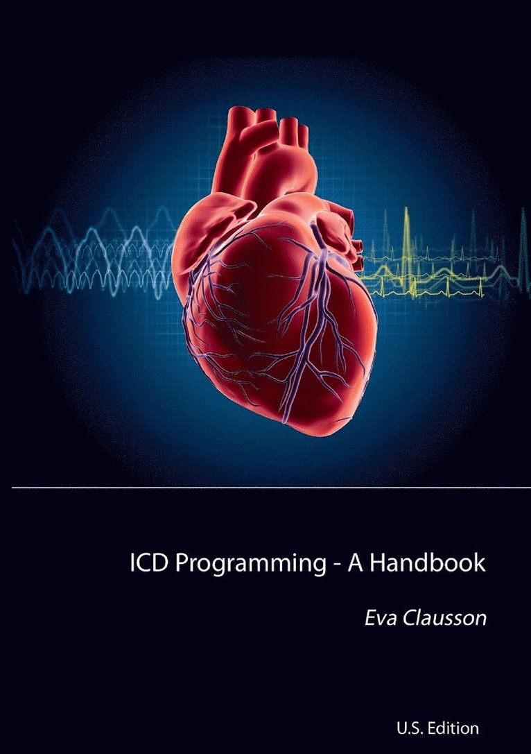 Eva Clausson - ICD Programming: A Handbook, E-bok