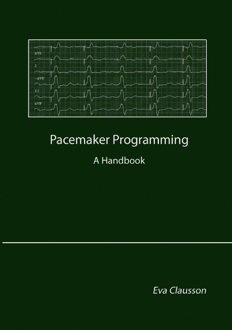 Eva Clausson - Pacemaker Programming, E-bok