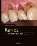 Karies : sjukdom och hl