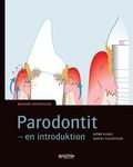 Parodontit : en introduktion