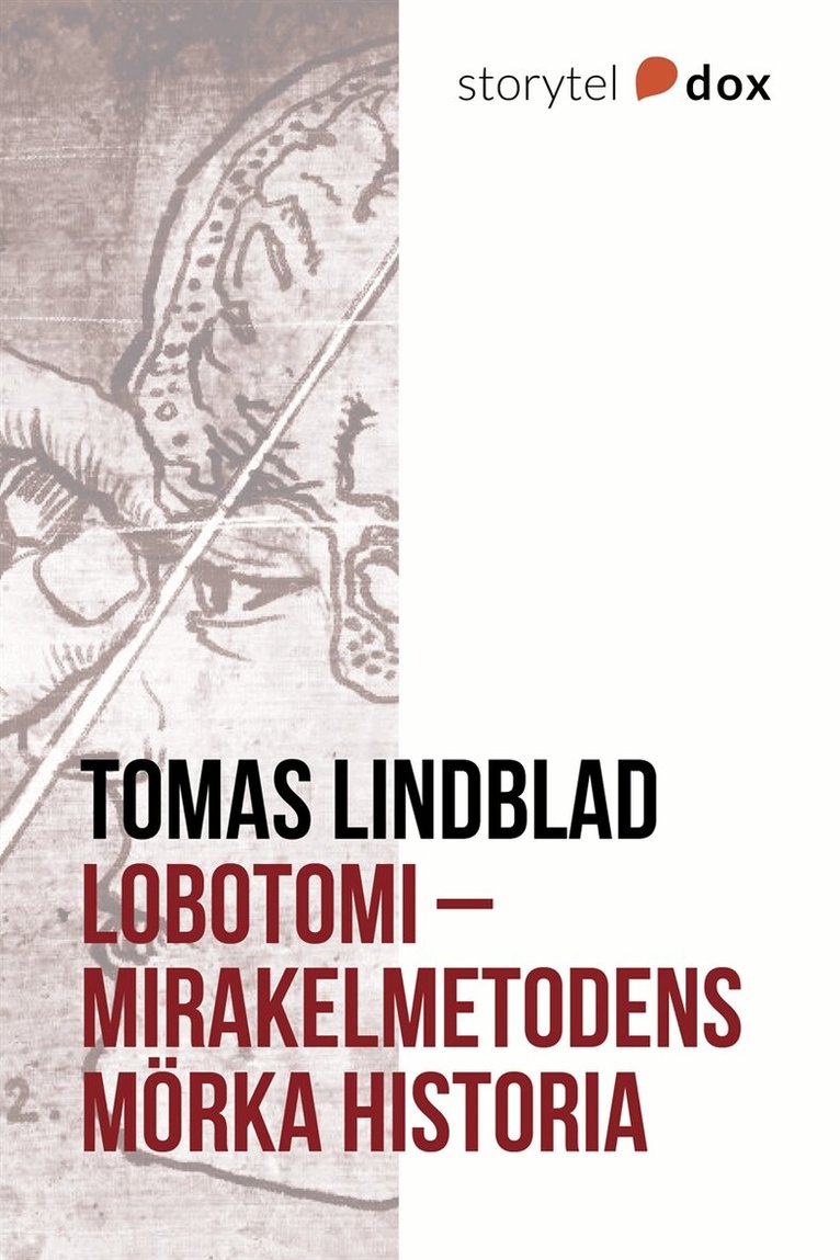 Tomas Lindblad - Lobotomi - Mirakelmetodens mörka historia, E-bok