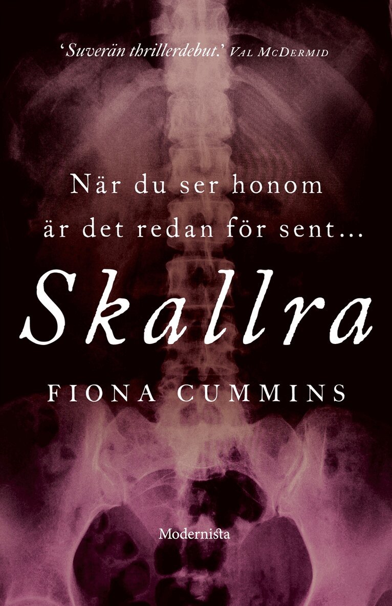 Fiona Cummins - Skallra (Första boken i Samlaren-serien), E-bok