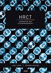 HRCT : diagnostik och sjukdomsöversikt