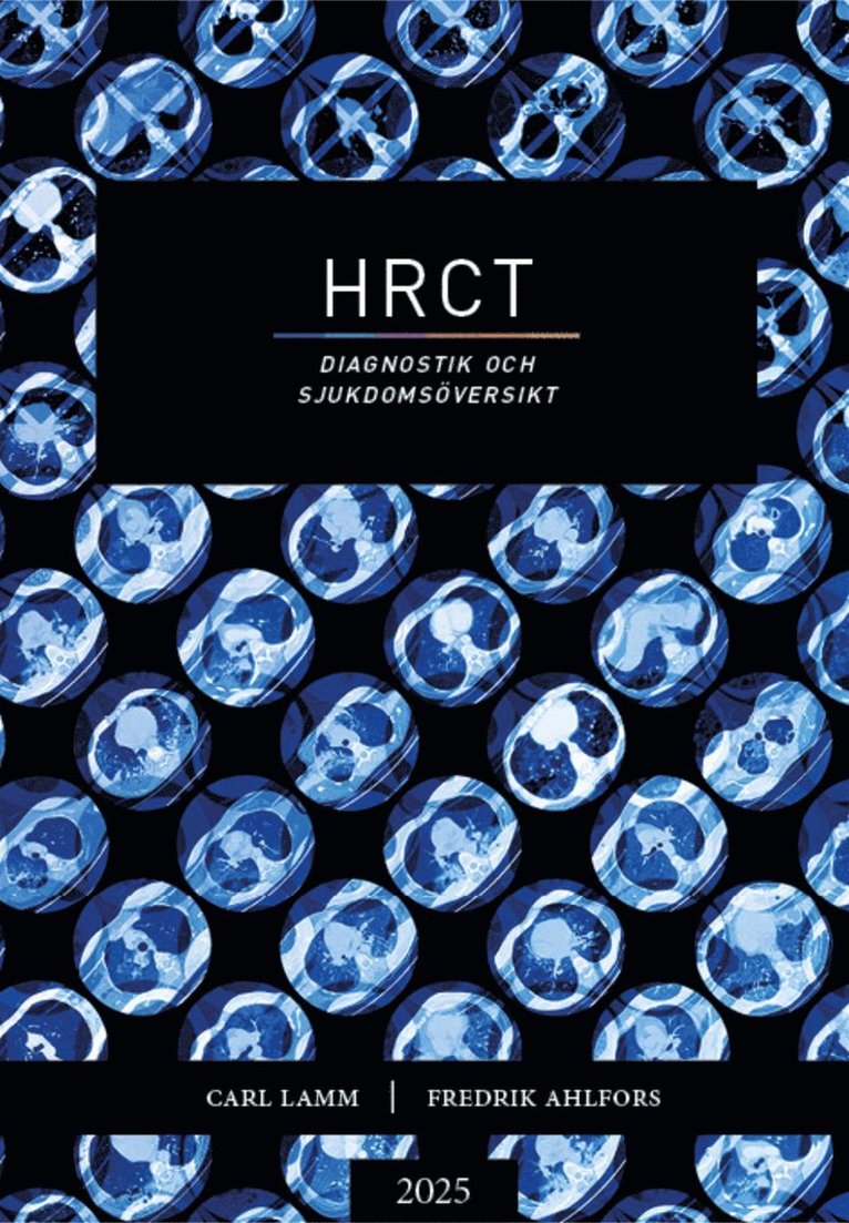 Fredrik Ahlfors, Carl Lamm - HRCT – Diagnostik och sjukdomsöversikt, E-bok