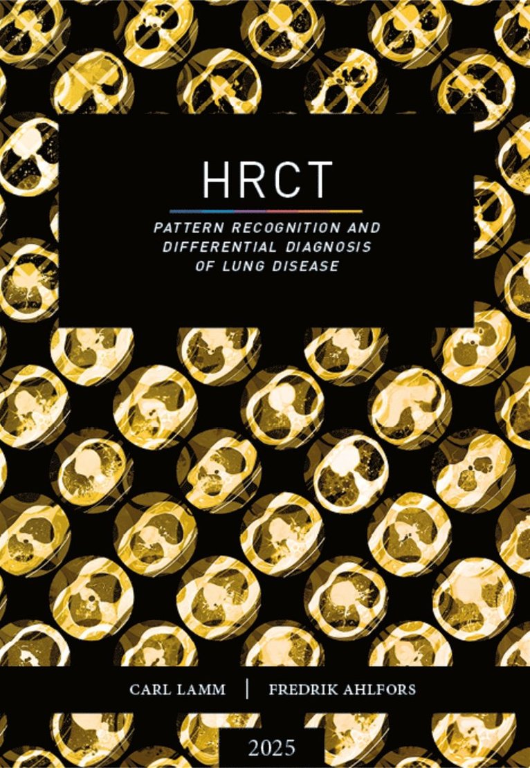 Fredrik Ahlfors, Carl Lamm - HRCT – pattern recognition and differential diagnosis of lung disease, E-bok