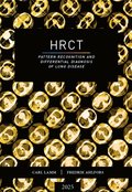 HRCT ? pattern recognition and differential diagnosis of lung disease