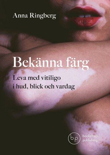 Anna Ringberg - Bekänna färg : leva med vitiligo i hud, blick och vardag, Häftad