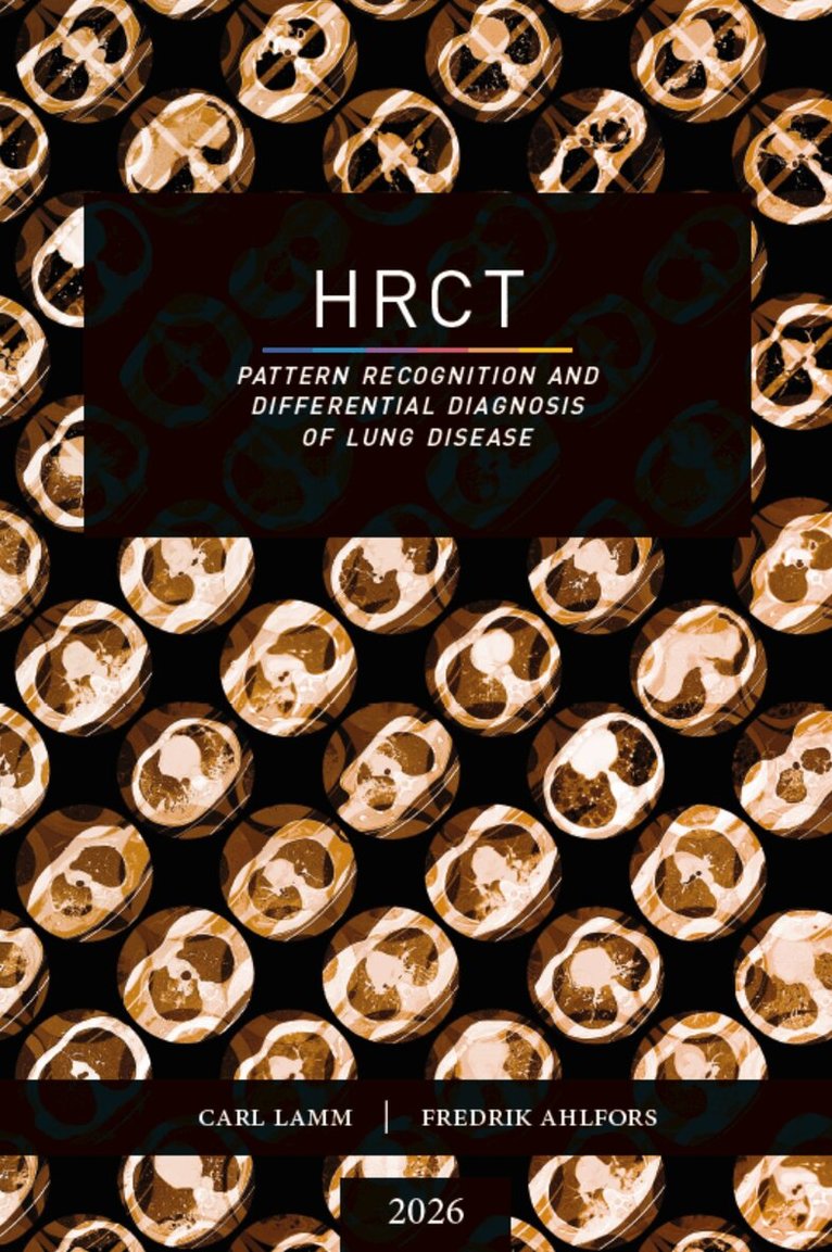 Fredrik Ahlfors, Carl Lamm - HRCT - Pattern Recognition and Differential Diagnosis of Lung Disease, Häftad. Tillgänglighet: Lägg i varukorg