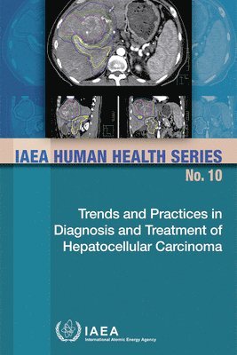 IAEA, International Atomic Energy Agency - Trends and Practices in Diagnosis and Treatment of Hepatocellular Carcinoma, Häftad. Tillgänglighet: Tillfälligt slut