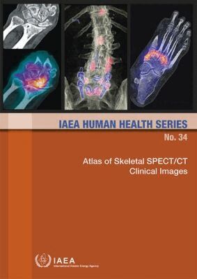 IAEA, International Atomic Energy Agency - Atlas of Skeletal SPECT/CT Clinical Images, Häftad. Tillgänglighet: Tillfälligt slut