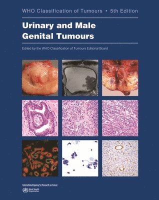 International Agency for Research on Cancer, H. Moch - WHO classification of tumours of the urinary system and male genital organs, Häftad
