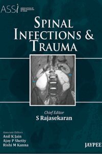 S Rajasekaran - Spinal Infections and Trauma, Inbunden