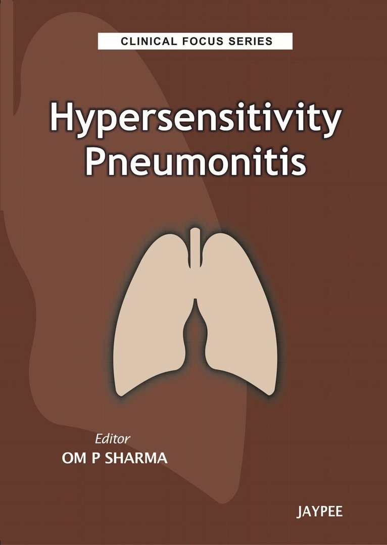 Om P Sharma - Clinical Focus Series:, Häftad