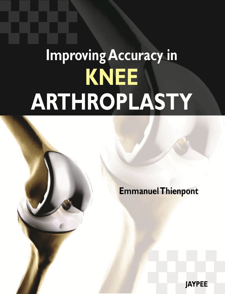 Emmanuel Thienpont - Improving Accuracy in Knee Arthroplasty, Inbunden