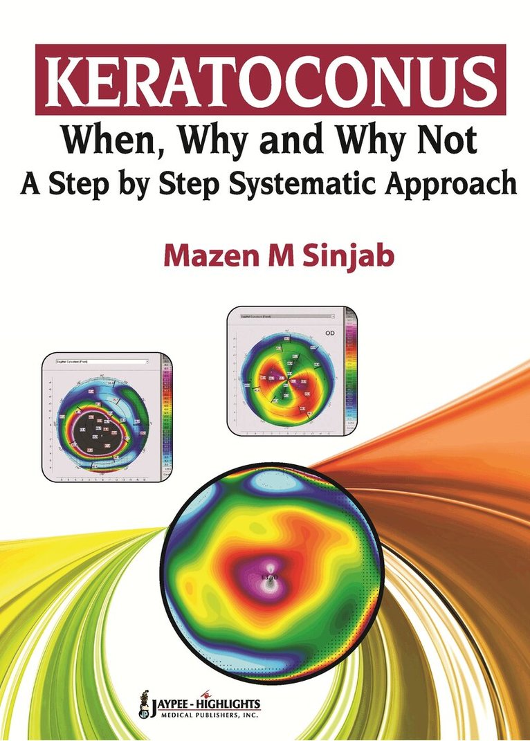Mazen M Sinjab - Keratoconus: When, Why and Why Not: A Step by Step Systematic Approach, Häftad