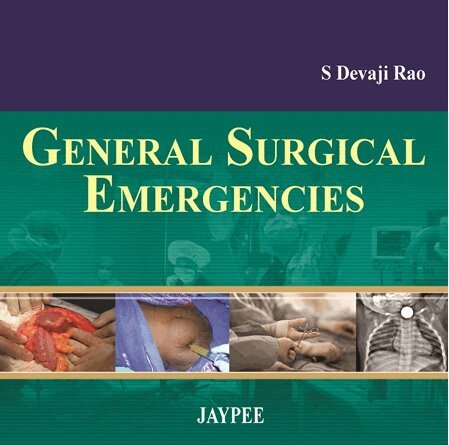 S Devaji Rao - General Surgical Emergencies, Häftad. Tillgänglighet: Tillfälligt slut