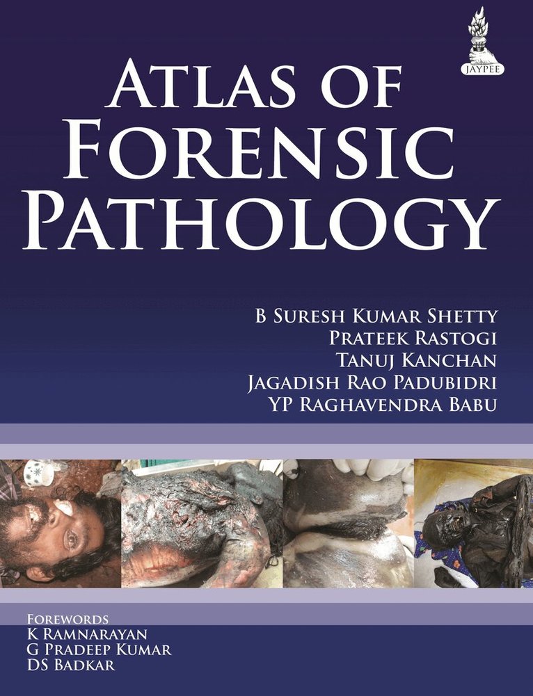 B Suresh Kumar Shetty, Prateek Rastogi, Tanuj Kanchan, Jagadish Rao Padubidri, YP Raghavendra Babu - Atlas of Forensic Pathology, Häftad. Tillgänglighet: Tillfälligt slut