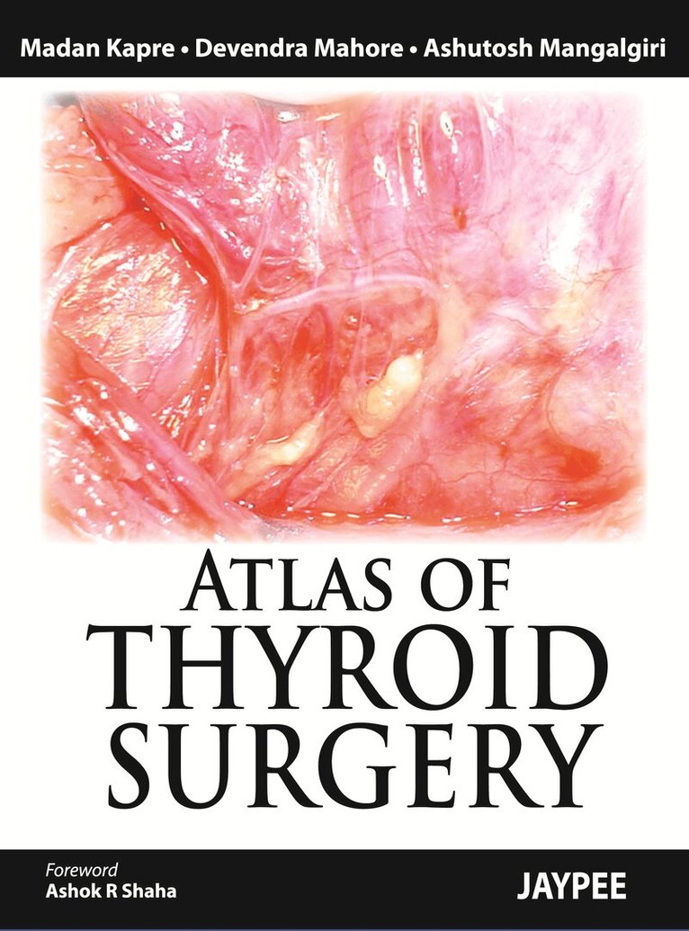 Madan Kapre, Devendra Mahore, Ashutosh Mangalgiri - Atlas of Thyroid Surgery, Inbunden