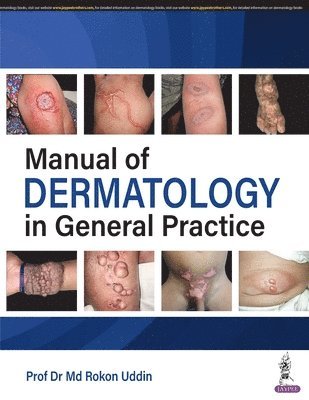 Md Rokon Uddin - Manual of Dermatology in General Practice, Övrigt