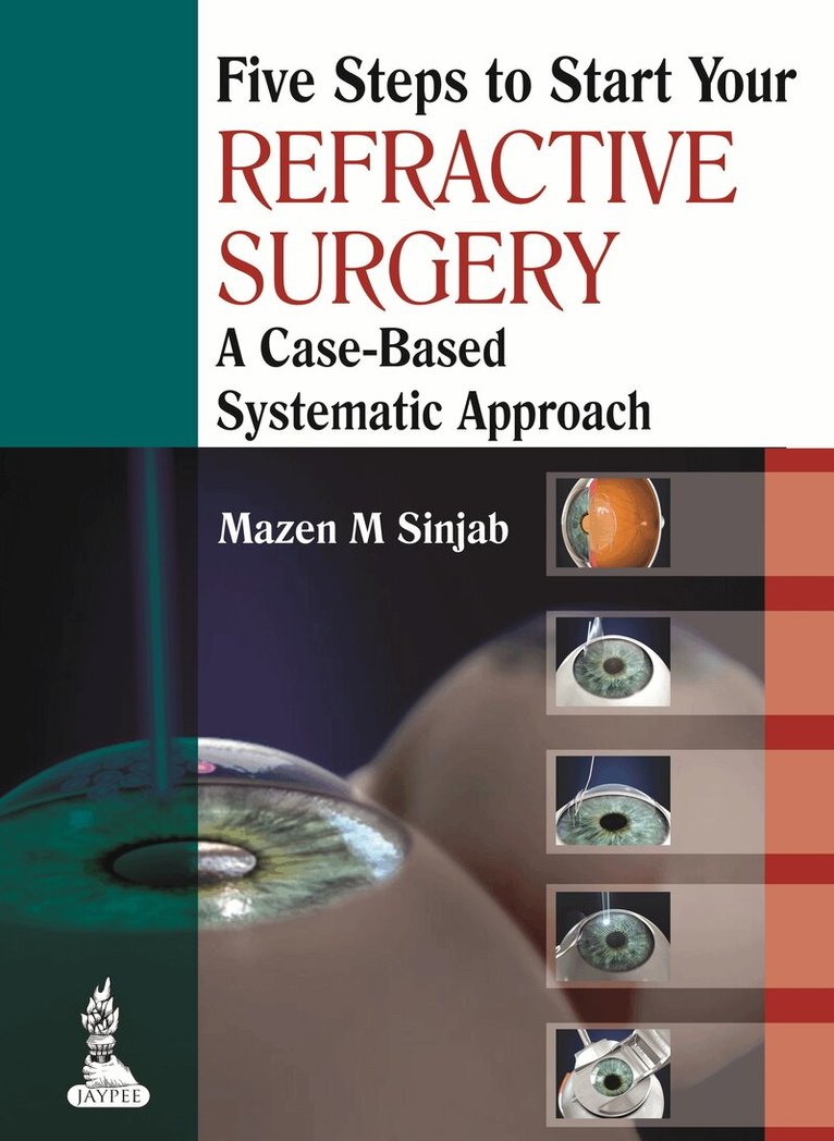 Mazen M Sinjab - Five Steps to Start Your Refractive Surgery, Häftad
