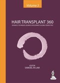 Hair Transplant 360 - Volume 3