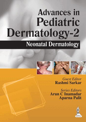Arun C Inamadar, Aparna Palit - Advances in Pediatric Dermatology - 2, Häftad. Tillgänglighet: Tillfälligt slut