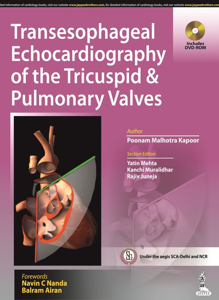Poonam Malhotra Kapoor - Transesophageal Echocardiography of the Tricuspid & Pulmonary Valves, Inbunden