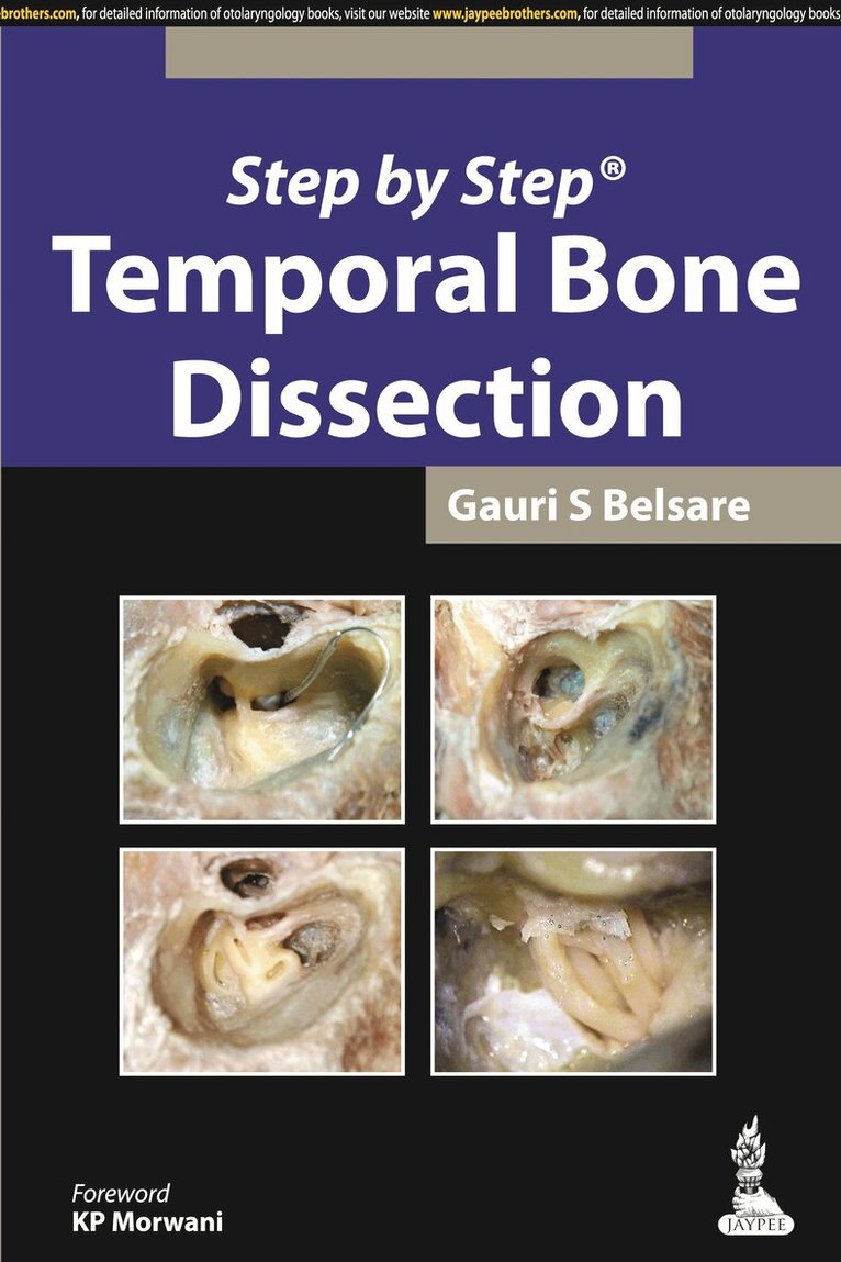 Gauri S Belsare - Step by Step: Temporal Bone Dissection, Häftad. Tillgänglighet: Lägg i varukorg