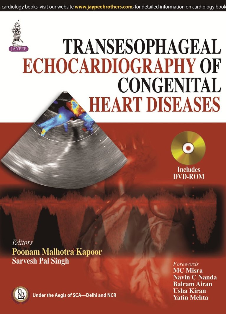 Poonam Malhotra Kapoor, Sarvesh Pal Singh - Transesophageal Echocardiography of Congenital Heart Diseases, Inbunden