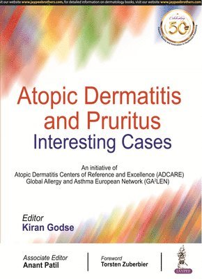Kiran Godse - Atopic Dermatitis and Pruritus, Häftad. Tillgänglighet: Lägg i varukorg