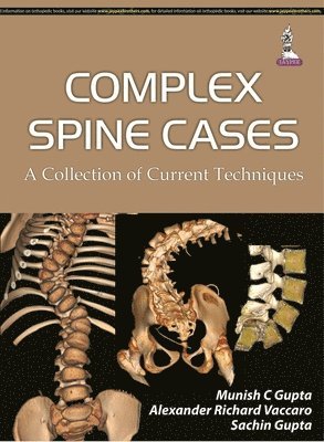 Complex Spine Cases: A Collection of Current Techniques av Munish C Gupta, Sachin Gupta, Alexander R Vaccaro