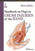 Handbook on Flaps in Crush Injuries of the Hand