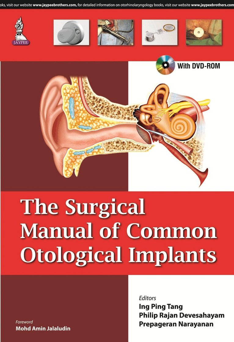 Ing Ping Tang, Philip Rajan Devesahayam, Prepageran Narayanan - Surgical Manual of Common Otological Implants, Inbunden