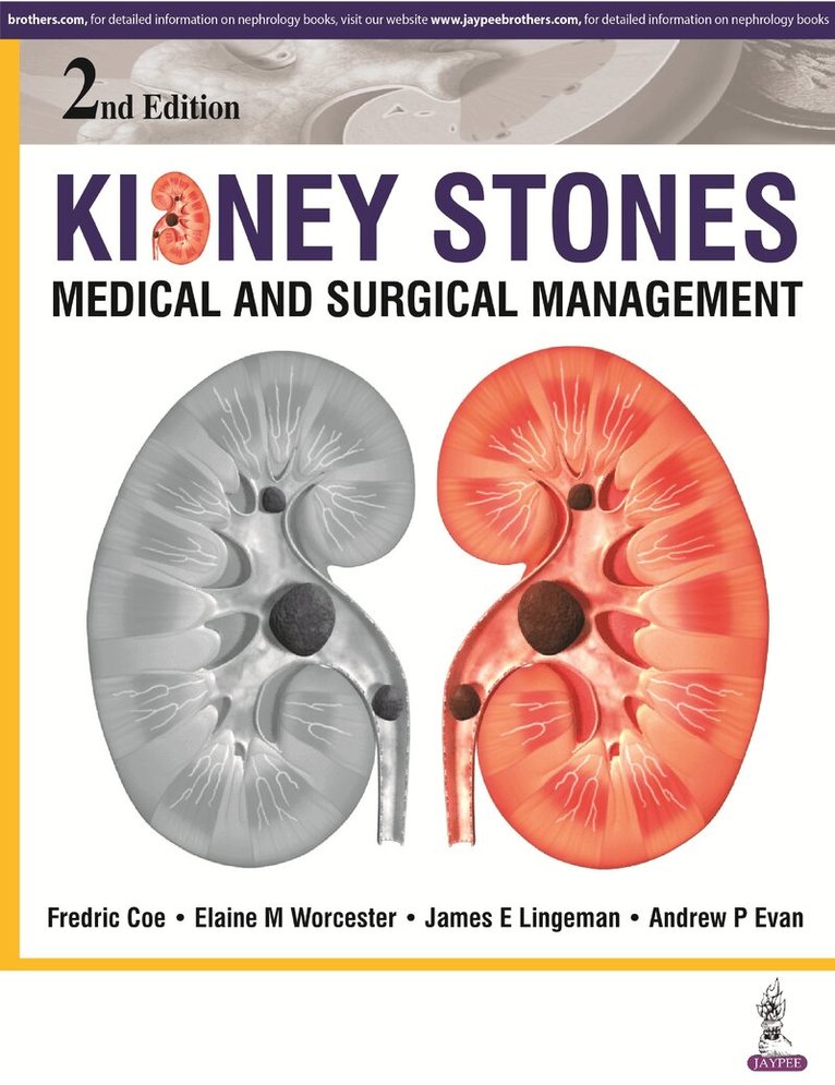 Fredric Coe, Elaine M Worcester, James E Lingeman, Andrew P Evan - Kidney Stones, Inbunden