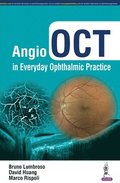 Angio OCT in Everyday Ophthalmic Practice