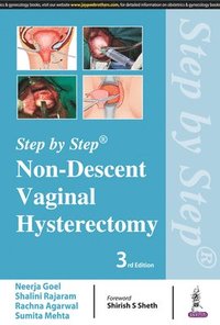 Step by Step: Non-Descent Vaginal Hysterectomy