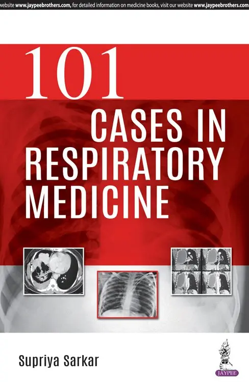 Supriya Sarkar - 101 Cases in Respiratory Medicine, Häftad. Tillgänglighet: Lägg i varukorg