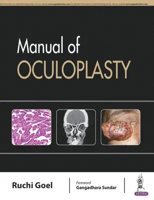 Ruchi Goel - Manual of Oculoplasty, Övrigt. Tillgänglighet: Lägg i varukorg