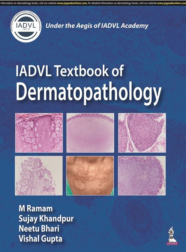 M Ramam, Sujay Khandpur, Neetu Bhari, Vishal Gupta - IADVL Textbook of Dermatopathology, Inbunden