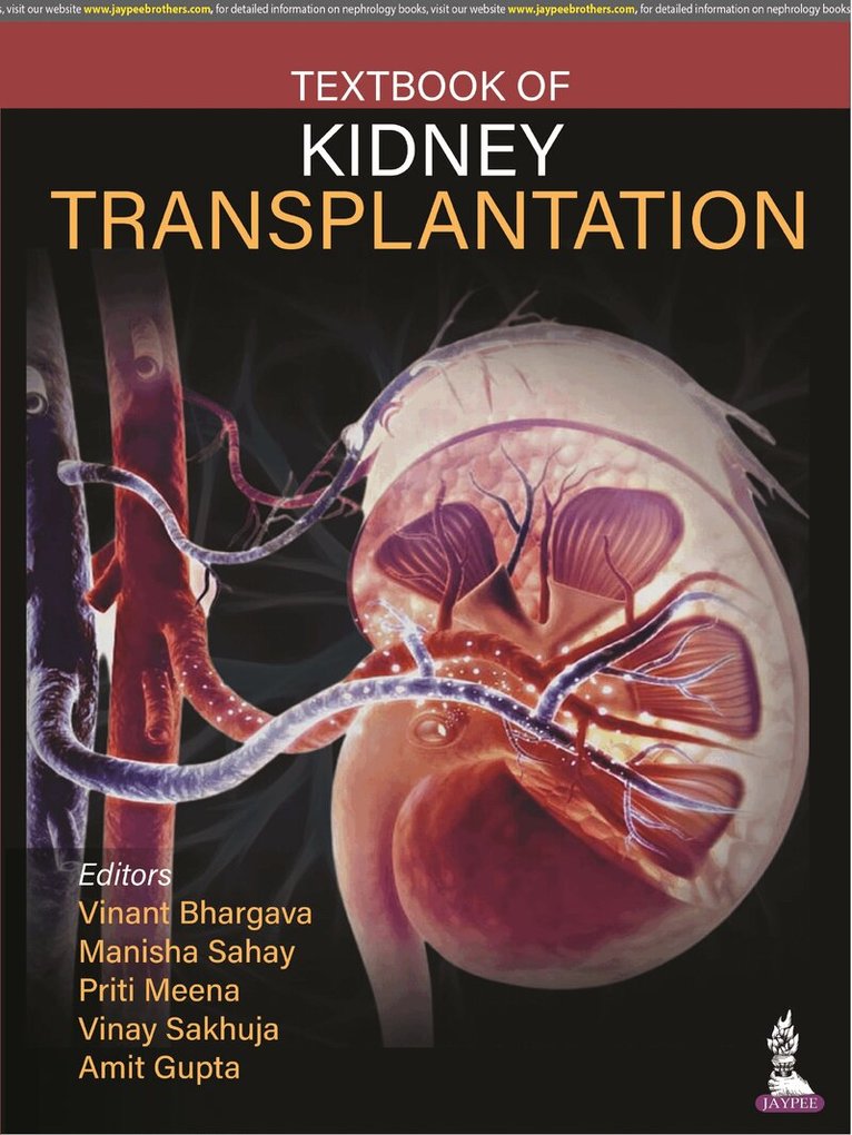 Vinant Bhargava, Manisha Sahay, Priti Meena, Vinay Sakhuja, Amit Gupta - Textbook of Kidney Transplantation, Häftad. Tillgänglighet: Lägg i varukorg