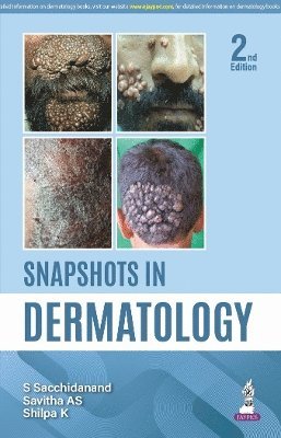 S Sacchidanand, Savitha AS, Shilpa K, Chaithra S - Snapshots in Dermatology, Häftad. Tillgänglighet: Tillfälligt slut