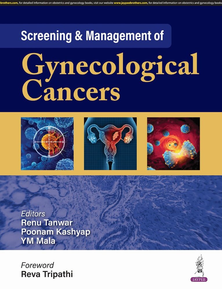 Renu Tanwar, Poonam Kashyap, YM Mala - Screening & Management of Gynecological Cancers, Häftad