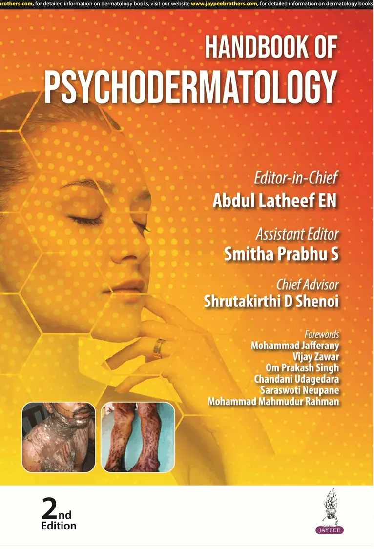 Abdul Latheef EN, Smitha Prabhu S, Shrutakirthi D Shenoi - Handbook of Psychodermatology, Häftad. Tillgänglighet: Lägg i varukorg
