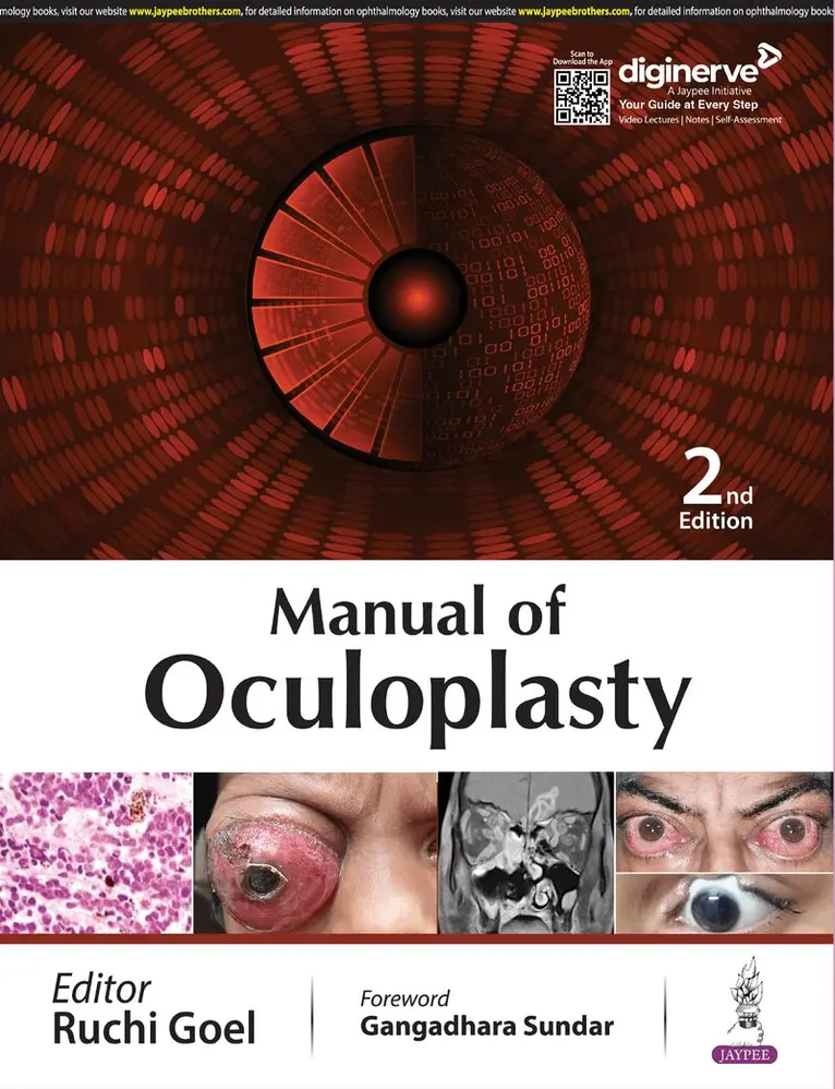 Ruchi Goel - Manual of Oculoplasty, Häftad. Tillgänglighet: Lägg i varukorg