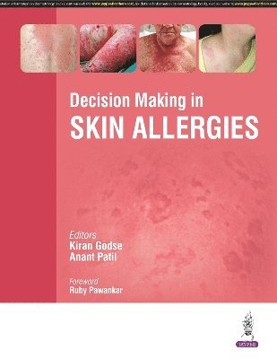 Kiran Godse, Anant Patil - Decision Making in Skin Allergies, Häftad. Tillgänglighet: Tillfälligt slut
