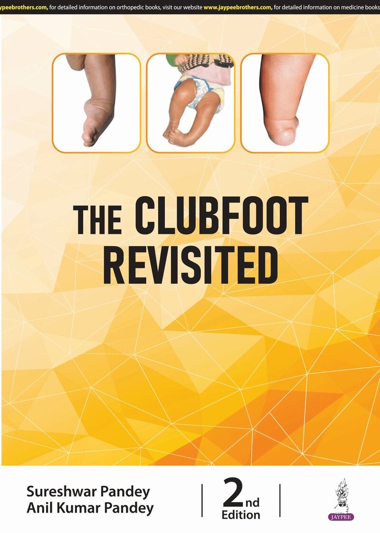Sureshwar Pandey, Anil Kumar Pandey - Clubfoot Revisited, Häftad